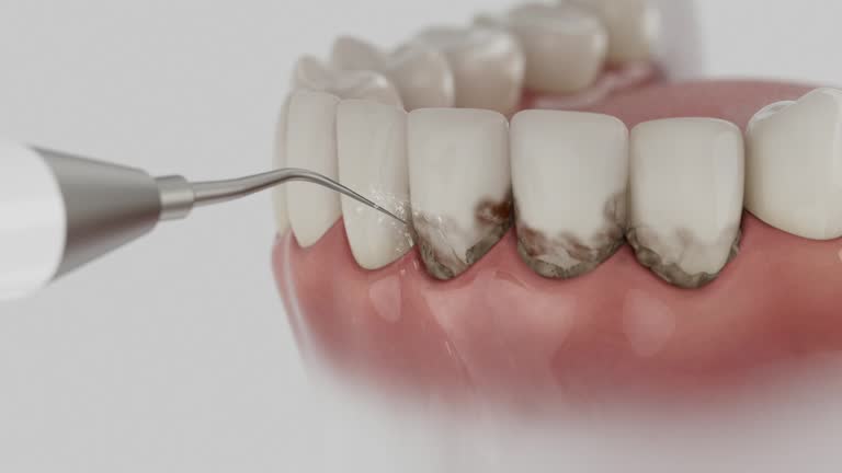 Trusted Tooth Extraction service in Hutchison, VA - Dentist Open Now